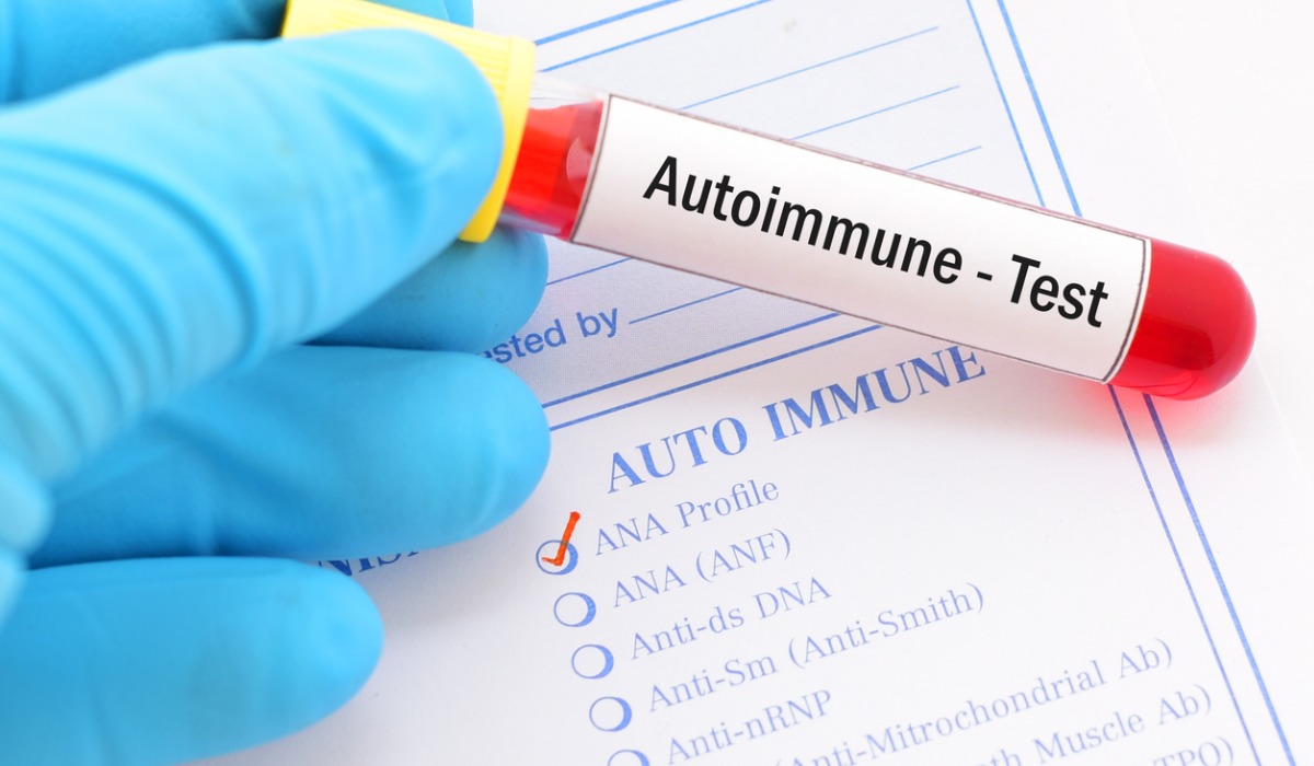 autoimmune